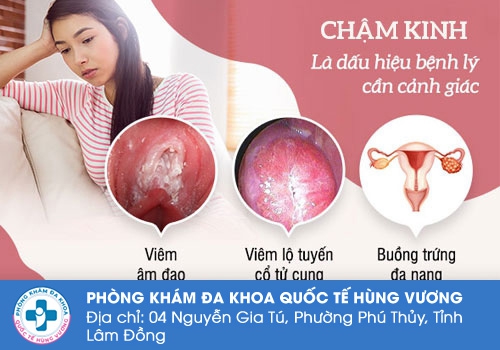 Chậm kinh là dấu hiệu của nhiều bệnh lý phụ khoa nguiy hiểm.